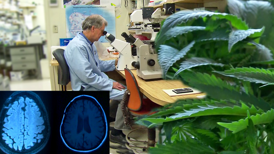 Researchers investigate cannabis compounds to treat Dementia